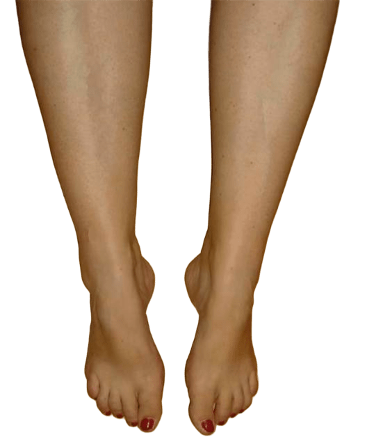 nohy bez otoků