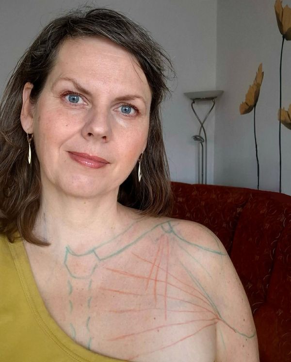 co dělat při karpálních tunelech